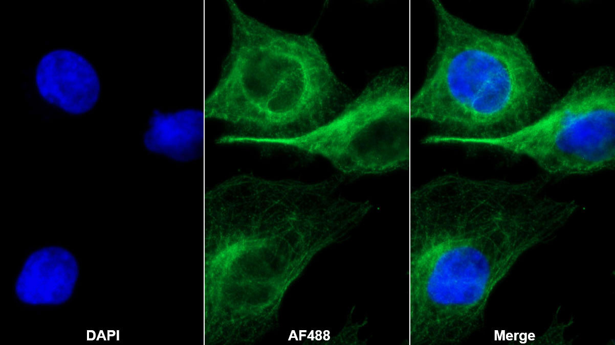 Monoclonal Antibody to Interleukin 15 (IL15)