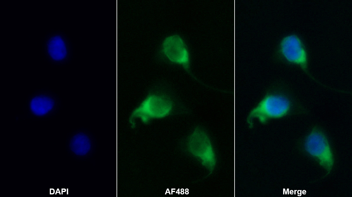Monoclonal Antibody to Interleukin 18 (IL18)