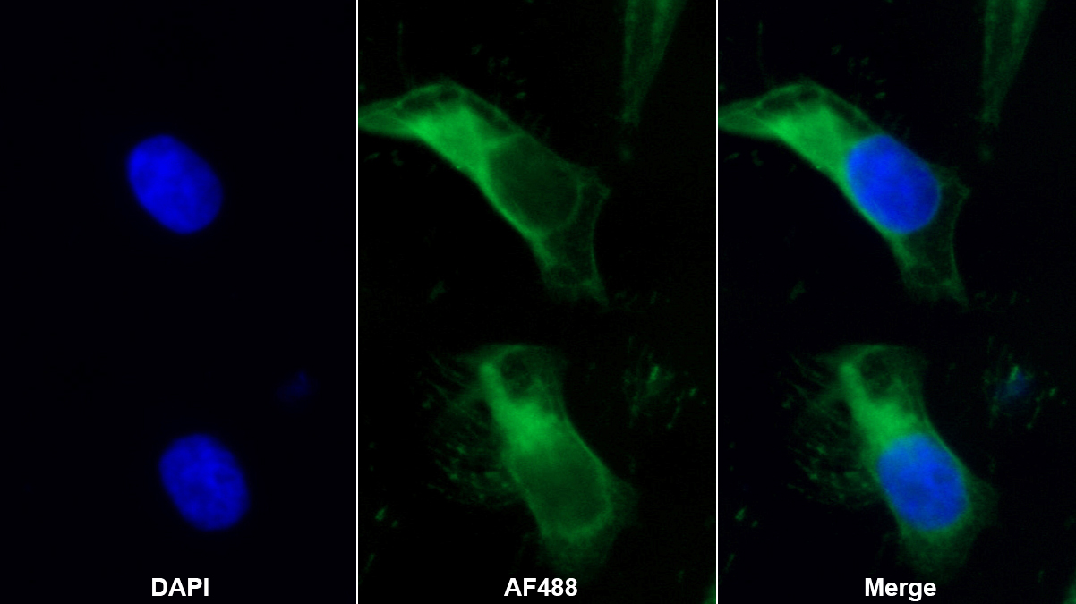 Monoclonal Antibody to Interleukin 18 (IL18)