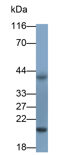 Monoclonal Antibody to Interleukin 18 (IL18)