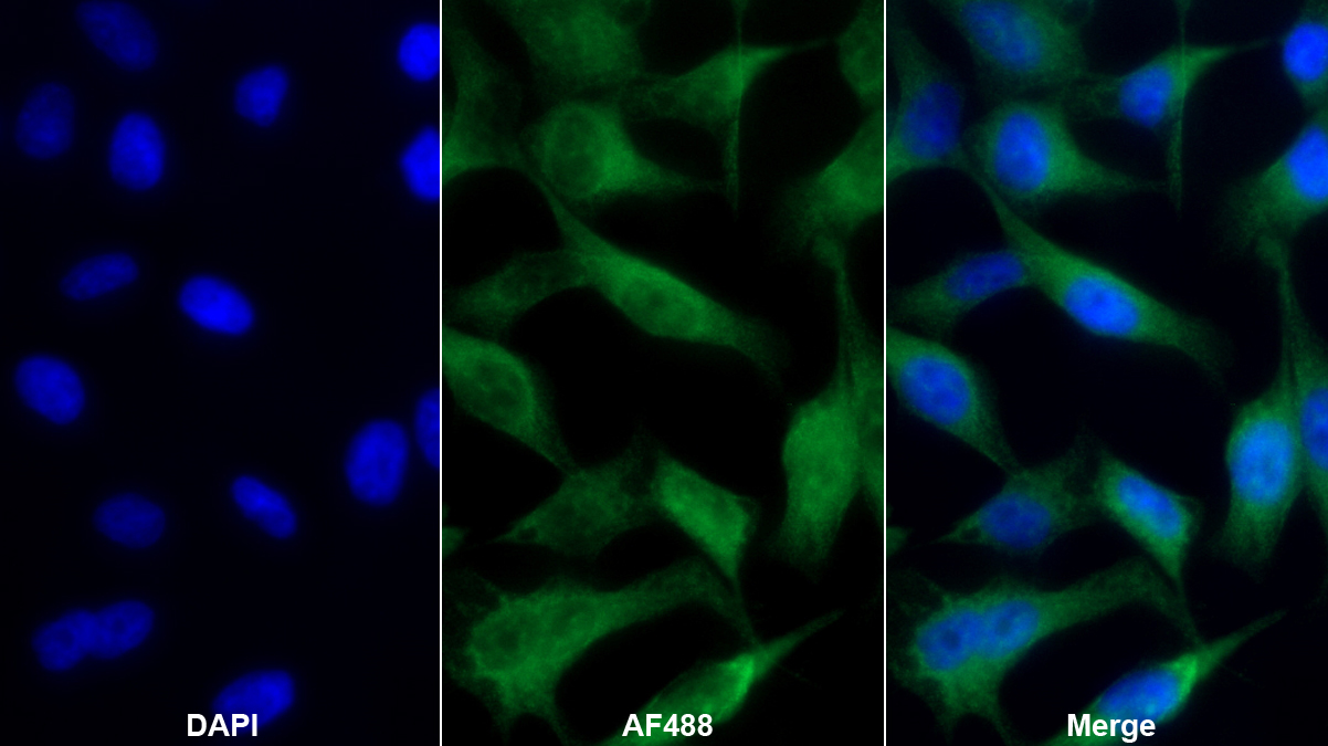 Monoclonal Antibody to Interleukin 18 (IL18)
