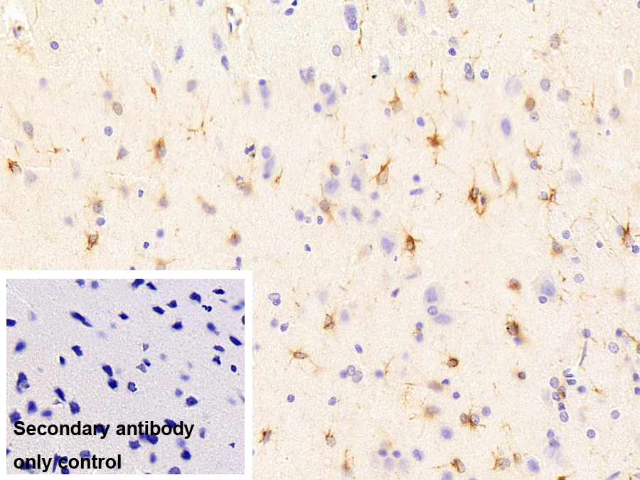 Monoclonal Antibody to Glial Fibrillary Acidic Protein (GFAP)