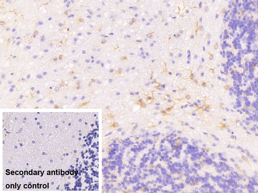 Monoclonal Antibody to Glial Fibrillary Acidic Protein (GFAP)