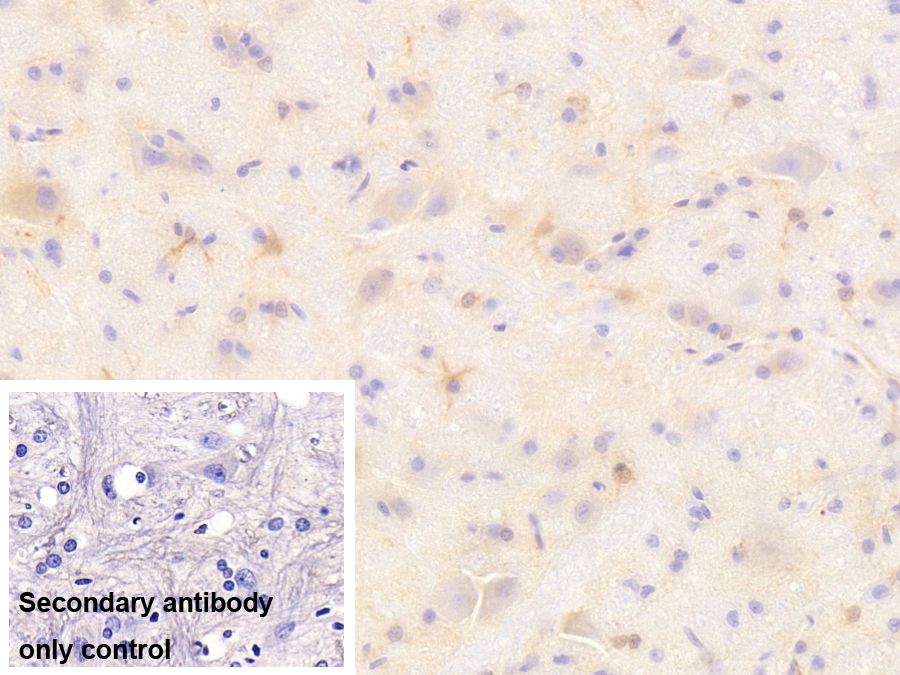 Monoclonal Antibody to Glial Fibrillary Acidic Protein (GFAP)