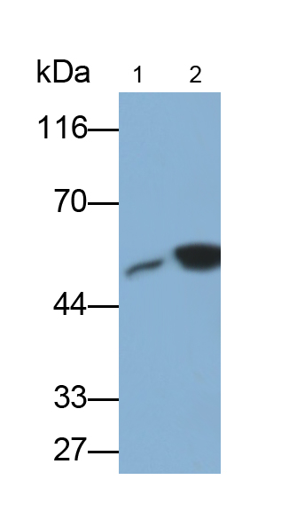 Monoclonal Antibody to Glial Fibrillary Acidic Protein (GFAP)