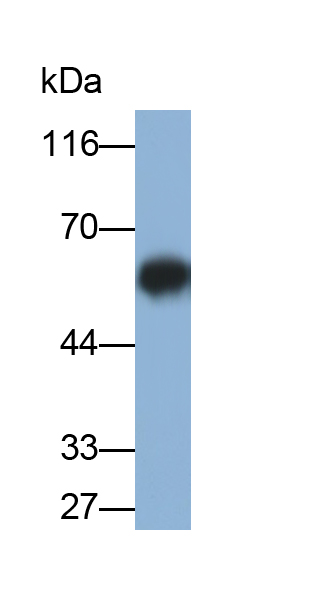 Monoclonal Antibody to Glial Fibrillary Acidic Protein (GFAP)