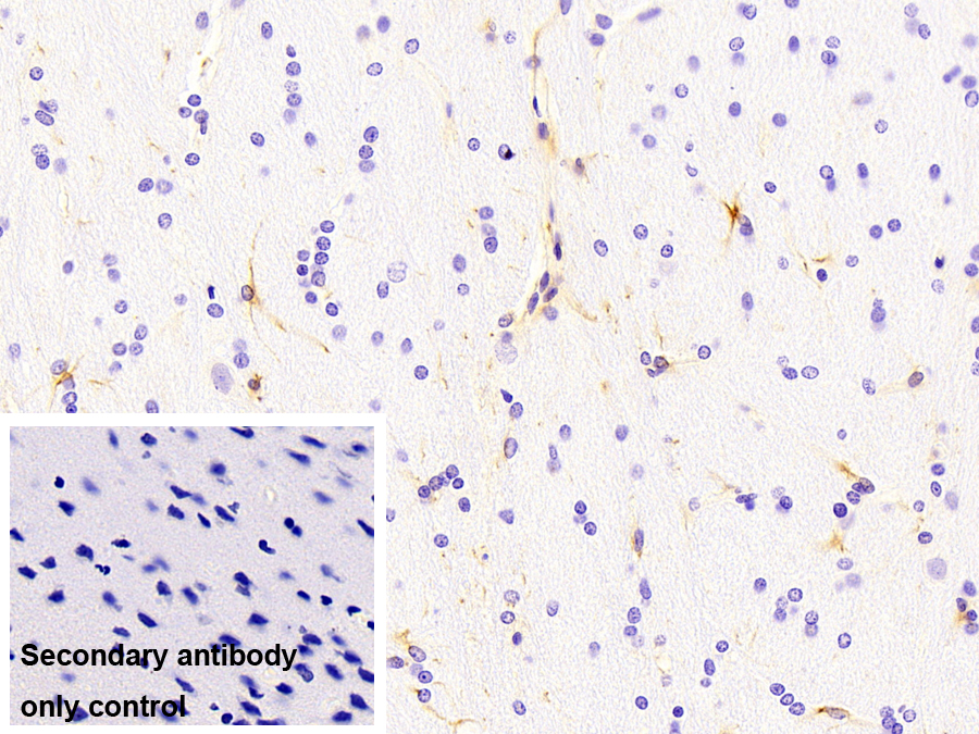 Monoclonal Antibody to Glial Fibrillary Acidic Protein (GFAP)