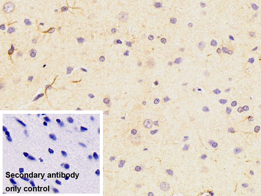 Monoclonal Antibody to Glial Fibrillary Acidic Protein (GFAP)