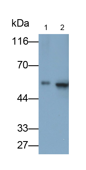 Monoclonal Antibody to Glial Fibrillary Acidic Protein (GFAP)