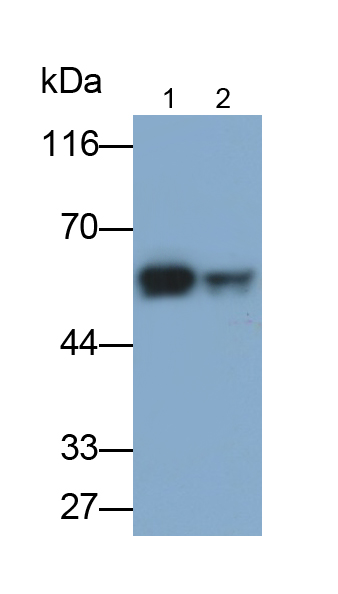 Monoclonal Antibody to Glial Fibrillary Acidic Protein (GFAP)