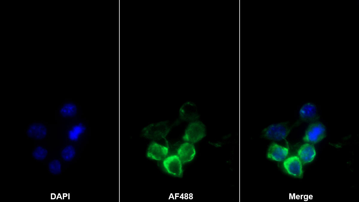 Monoclonal Antibody to Interleukin 1 Alpha (IL1a)