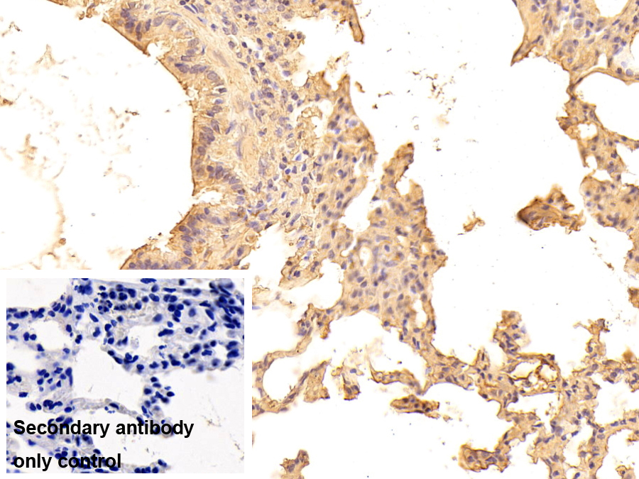 Monoclonal Antibody to Immunoglobulin G1 (IgG1)