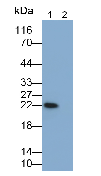 Monoclonal Antibody to Interleukin 6 (IL6)