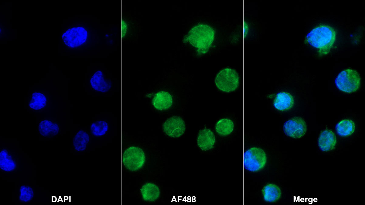 Monoclonal Antibody to Interleukin 8 (IL8)