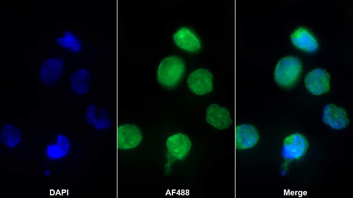 Monoclonal Antibody to Interleukin 8 (IL8)