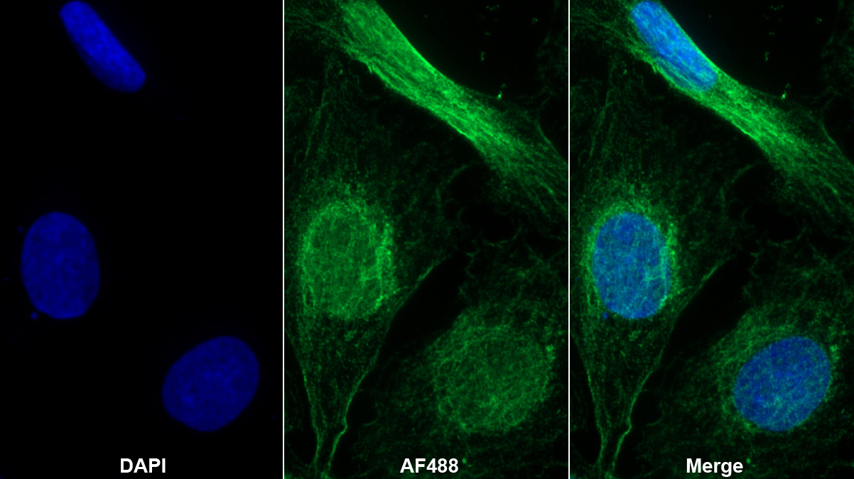 Monoclonal Antibody to Leukemia Inhibitory Factor (LIF)