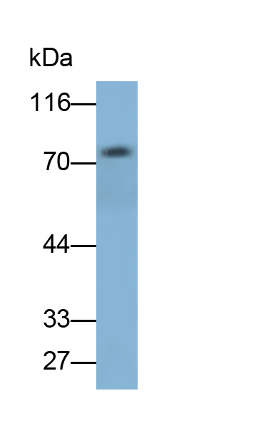 Monoclonal Antibody to Matrix Metalloproteinase 2 (MMP2)