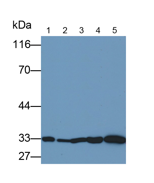 Monoclonal Antibody to Nerve Growth Factor (NGF)