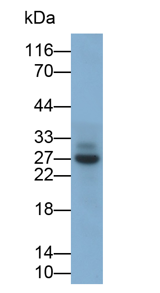 Monoclonal Antibody to Nerve Growth Factor (NGF)