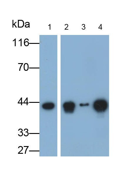 Monoclonal Antibody to Creatine Kinase, Muscle (CKM)