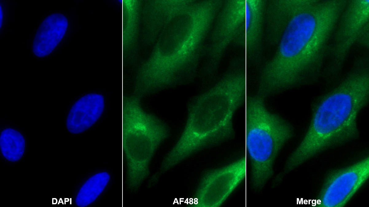 Monoclonal Antibody to Creatine Kinase, Muscle (CKM)