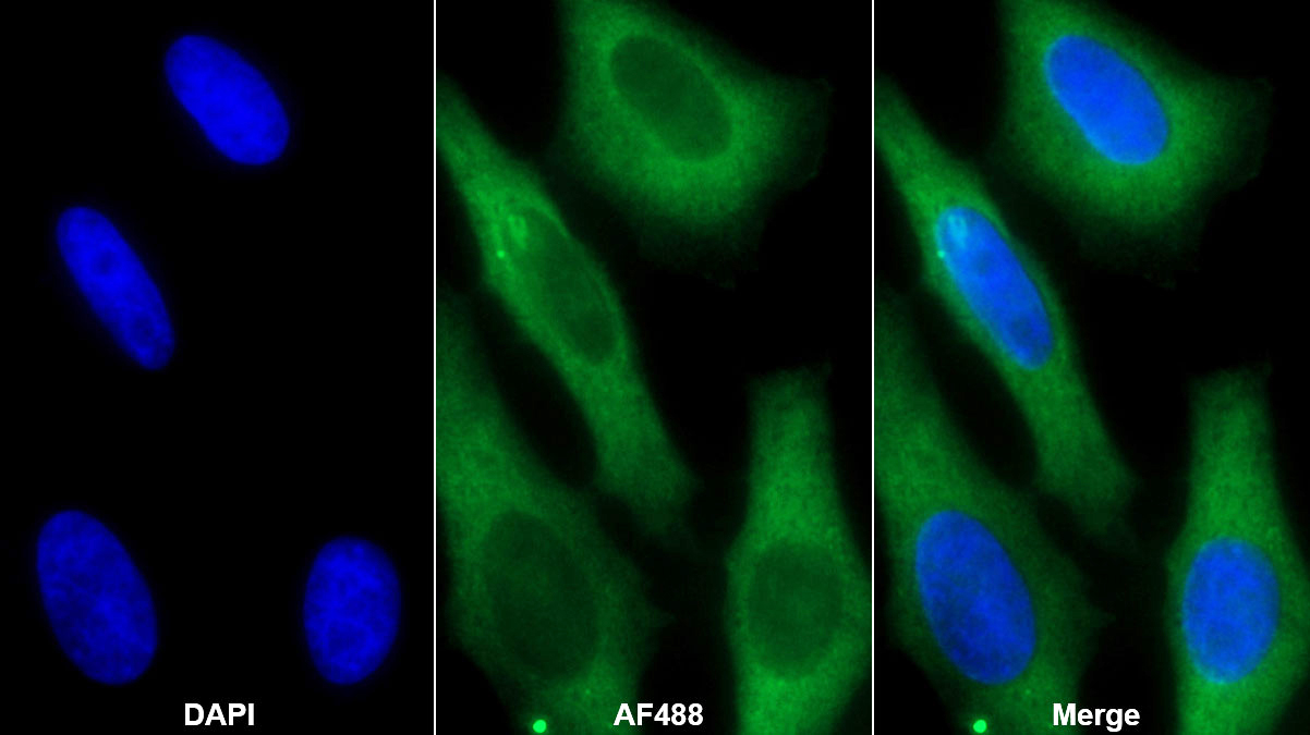 Monoclonal Antibody to Creatine Kinase, Muscle (CKM)