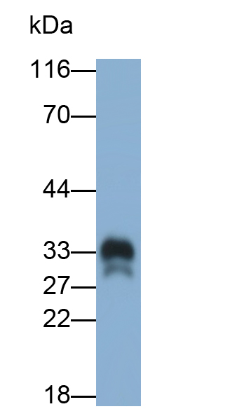 Monoclonal Antibody to Superoxide Dismutase 3, Extracellular (SOD3)