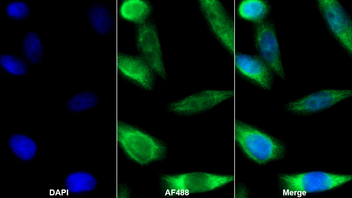 Monoclonal Antibody to Superoxide Dismutase 3, Extracellular (SOD3)