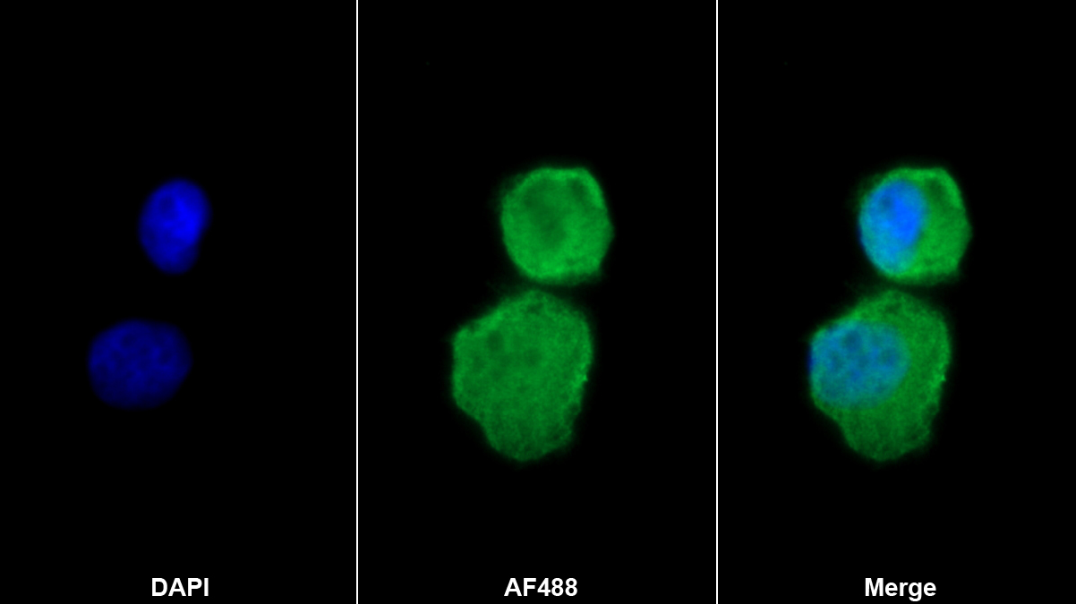 Monoclonal Antibody to Transforming Growth Factor Alpha (TGFa)