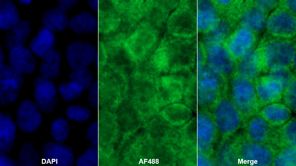 Monoclonal Antibody to Transforming Growth Factor Alpha (TGFa)