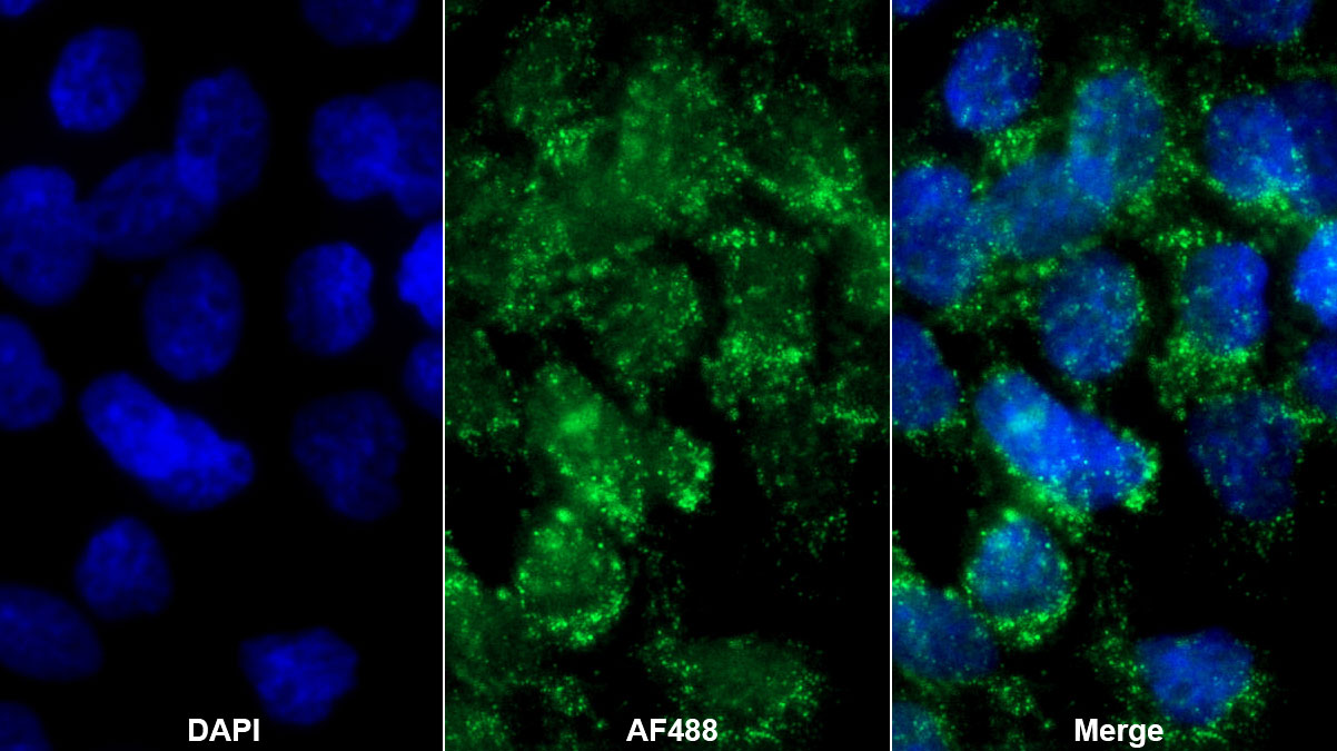 Monoclonal Antibody to Transforming Growth Factor Alpha (TGFa)