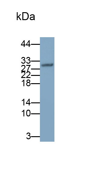 Monoclonal Antibody to Tumor Necrosis Factor Alpha (TNFa)