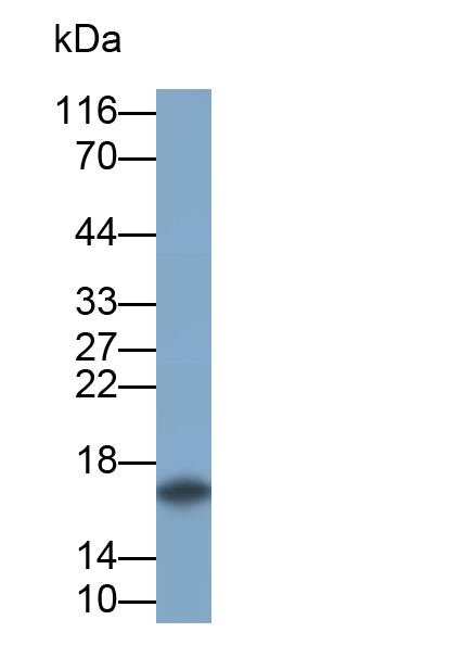 Monoclonal Antibody to Tumor Necrosis Factor Alpha (TNFa)