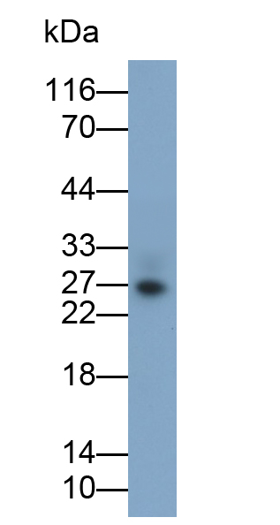 Monoclonal Antibody to Tumor Necrosis Factor Alpha (TNFa)