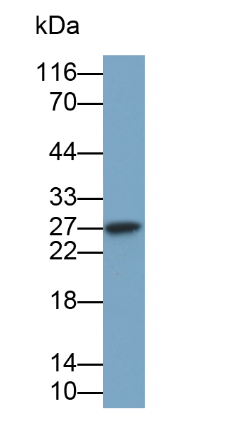 Monoclonal Antibody to Tumor Necrosis Factor Alpha (TNFa)