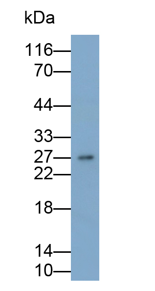 Monoclonal Antibody to Tumor Necrosis Factor Alpha (TNFa)