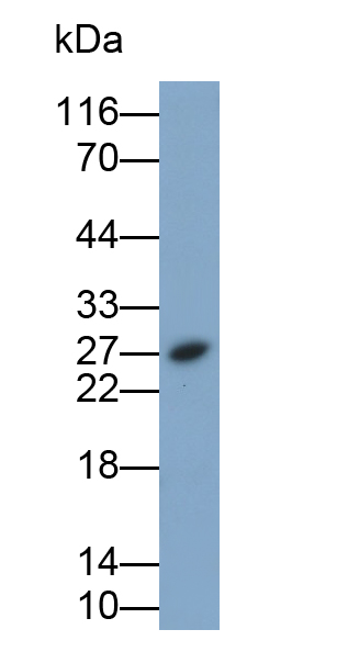 Monoclonal Antibody to Tumor Necrosis Factor Alpha (TNFa)