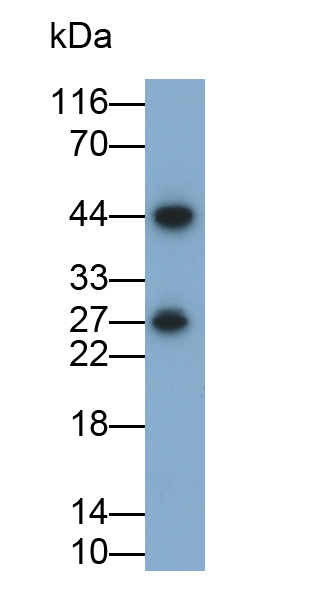 Monoclonal Antibody to Tumor Necrosis Factor Alpha (TNFa)