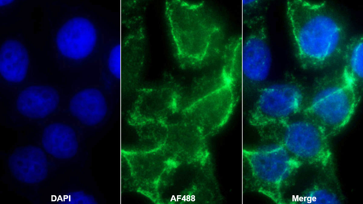 Monoclonal Antibody to Tumor Necrosis Factor Related Apoptosis Inducing Ligand (TRAIL)
