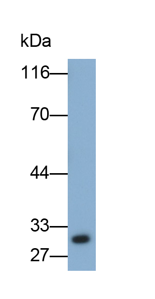 Monoclonal Antibody to Tumor Necrosis Factor Related Apoptosis Inducing Ligand (TRAIL)