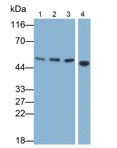 Monoclonal Antibody to Plasminogen Activator, Urokinase (uPA)