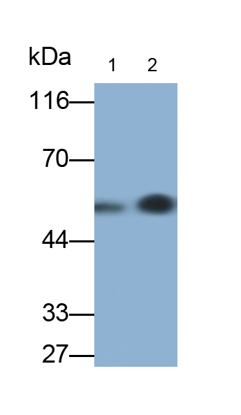 Monoclonal Antibody to Plasminogen Activator, Urokinase (uPA)