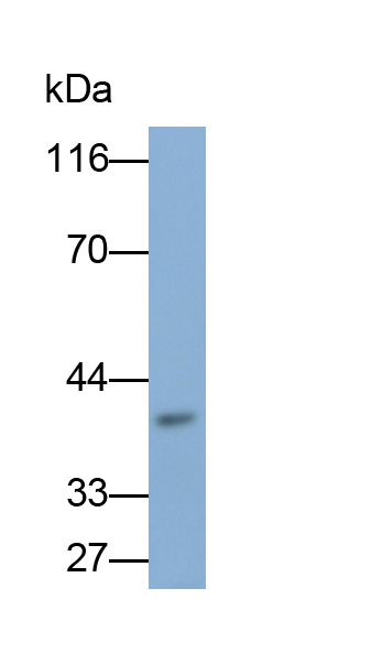 Monoclonal Antibody to Plasminogen Activator, Urokinase Receptor (uPAR)