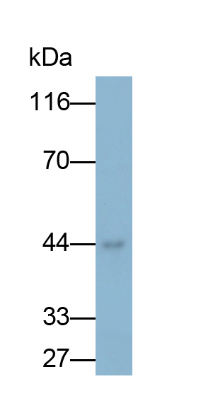 Monoclonal Antibody to Plasminogen Activator, Urokinase Receptor (uPAR)