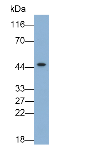 Monoclonal Antibody to Vascular Endothelial Growth Factor A (VEGFA)