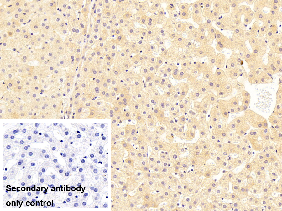 Monoclonal Antibody to Vascular Endothelial Growth Factor A (VEGFA)