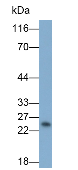 Monoclonal Antibody to Vascular Endothelial Growth Factor A (VEGFA)