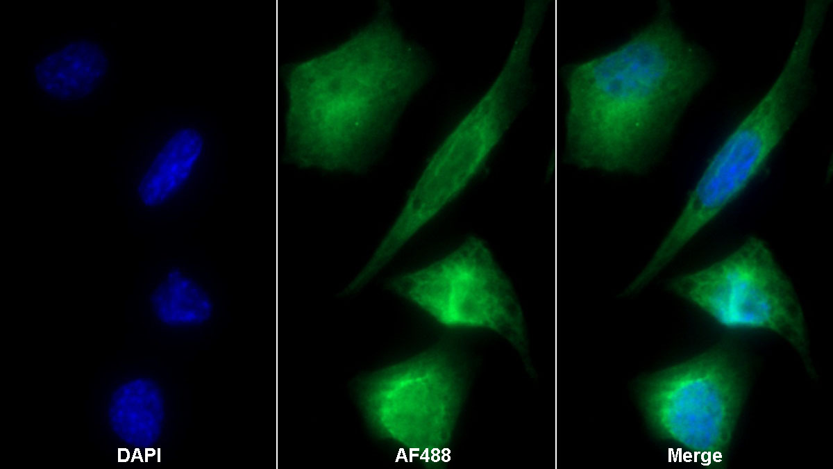 Monoclonal Antibody to Collagen Type IV Alpha 1 (COL4a1)