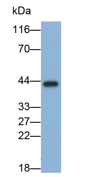 Monoclonal Antibody to Pepsinogen A (PGA)