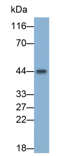 Monoclonal Antibody to Pepsinogen C (PGC)